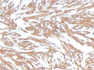 Immunohistochemistry-Paraffin: alpha-Smooth Muscle Actin Antibody (ACTA2/791) - Azide and BSA Free [NBP2-47698]