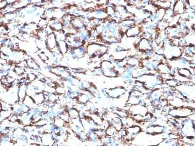 Immunohistochemistry-Paraffin: alpha-Smooth Muscle Actin Antibody (ACTA2/791) - Azide and BSA Free [NBP2-47698]