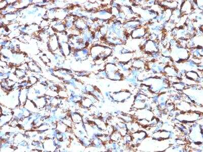 Immunohistochemistry-Paraffin: alpha-Smooth Muscle Actin Antibody (ACTA2/791) - IHC-Prediluted [NBP2-48132]