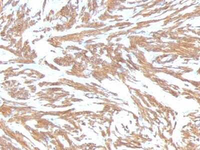 Immunohistochemistry-Paraffin: alpha-Smooth Muscle Actin Antibody (ACTA2/791) [NBP2-44463]