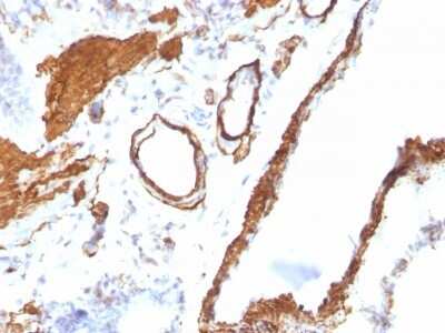 Immunohistochemistry-Paraffin: alpha-Smooth Muscle Actin Antibody (ACTA2/791) [NBP2-44463]