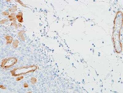 Immunohistochemistry-Paraffin: alpha-Smooth Muscle Actin Antibody (BLR082G) [NBP2-78836]