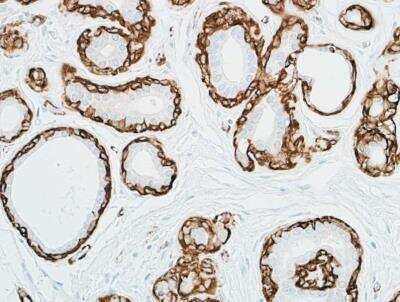 Immunohistochemistry-Paraffin: alpha-Smooth Muscle Actin Antibody (BLR082G) [NBP2-78836]