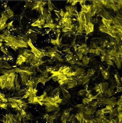 Immunocytochemistry/ Immunofluorescence: alpha-Smooth Muscle Actin Antibody [NB300-978]