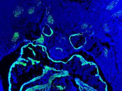 Immunohistochemistry-Frozen: alpha-Smooth Muscle Actin Antibody [NBP1-30894]