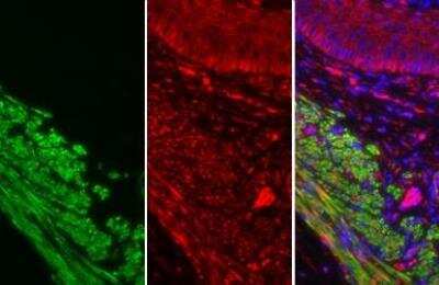 Immunohistochemistry-Paraffin: alpha-Smooth Muscle Actin Antibody [NBP1-30894]