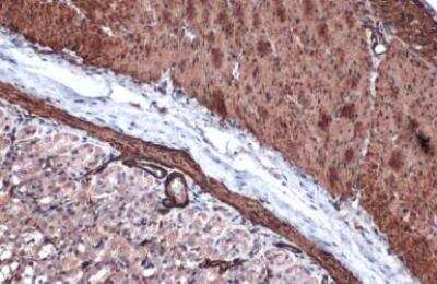 Immunohistochemistry-Paraffin: alpha-Smooth Muscle Actin Antibody [NBP1-30894]