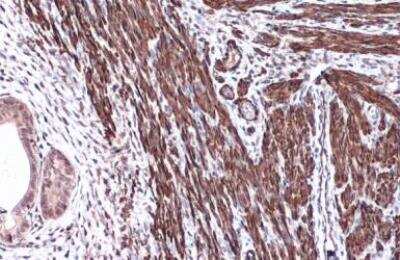 Immunohistochemistry-Paraffin: alpha-Smooth Muscle Actin Antibody [NBP1-30894]