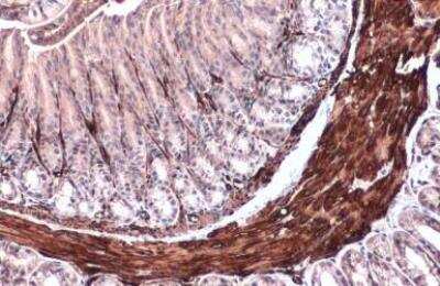 Immunohistochemistry-Paraffin: alpha-Smooth Muscle Actin Antibody [NBP1-30894]
