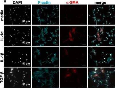 Immunohistochemistry: alpha-Smooth Muscle Actin Antibody (SPM332) - Azide and BSA Free [NBP2-34760]