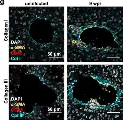 Immunohistochemistry: alpha-Smooth Muscle Actin Antibody (SPM332) - Azide and BSA Free [NBP2-34760]