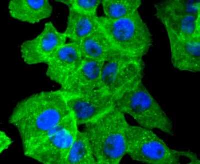 Immunocytochemistry/ Immunofluorescence: alpha-Smooth Muscle Actin Antibody (SY02-64) [NBP2-67440]