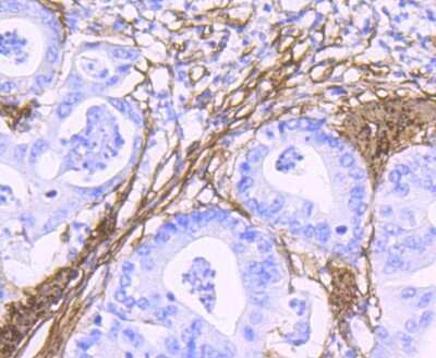 Immunohistochemistry-Paraffin: alpha-Smooth Muscle Actin Antibody (SY02-64) [NBP2-67440]