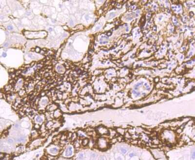 Immunohistochemistry-Paraffin: alpha-Smooth Muscle Actin Antibody (SY02-64) [NBP2-67440]