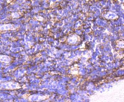 Immunohistochemistry-Paraffin: alpha-Smooth Muscle Actin Antibody (SY02-64) [NBP2-67440]