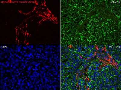 Immunohistochemistry-Paraffin: alpha-Smooth Muscle Actin Antibody (SY02-64) [NBP2-67440]