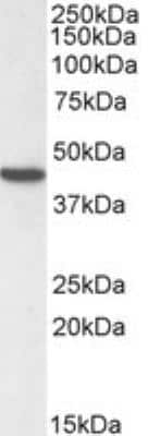 Western Blot: alpha-Smooth Muscle Actin Antibody [NB300-978]