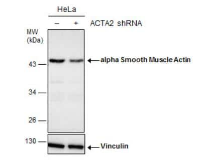 Knockdown Validated: alpha-Smooth Muscle Actin Antibody [NBP1-30894]