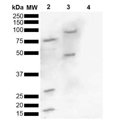 Western Blot: alpha-Synuclein [p Ser129] Antibody [NBP2-61121]