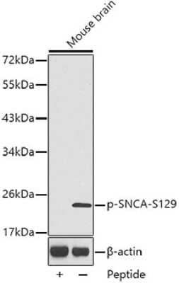 Western Blot: alpha-Synuclein [p Ser129] AntibodyAzide and BSA Free [NBP3-05429]