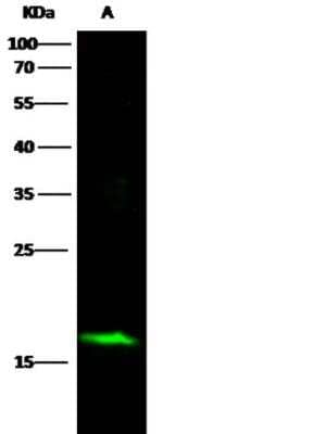 Western Blot: alpha-Synuclein Antibody (017) [NBP2-90051]