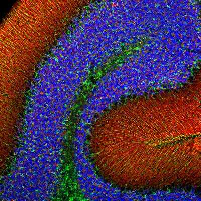 Immunohistochemistry Free-Floating: alpha-Synuclein Antibody (2A7) [NBP1-05194]