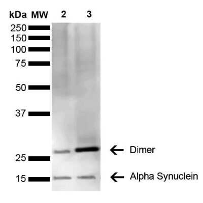 Western Blot: alpha-Synuclein Antibody (3C11) [NBP3-18258]