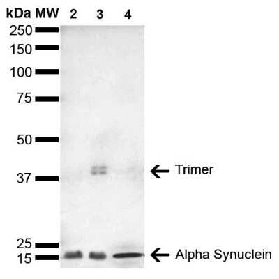 Western Blot: alpha-Synuclein Antibody (4F1) [NBP3-18259]