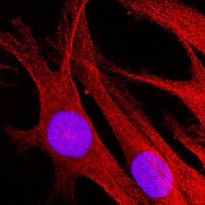 Immunocytochemistry/ Immunofluorescence: alpha-Synuclein Antibody (970106) - Azide and BSA Free [MAB13382]