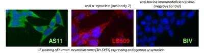 Immunocytochemistry/ Immunofluorescence: alpha-Synuclein Antibody (AS11) [DDX0910P-100]