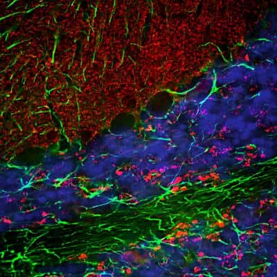 Immunohistochemistry: alpha-Synuclein Antibody [NBP2-25146]