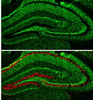 Immunohistochemistry-Frozen: alpha-Synuclein Antibody [NBP2-15365]