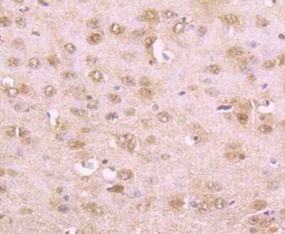 Immunohistochemistry-Paraffin: alpha-Synuclein Antibody (JB22-44) [NBP2-75409]