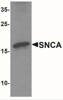 Western Blot: alpha-Synuclein AntibodyBSA Free [NBP2-41288]