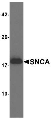 Western Blot: alpha-Synuclein AntibodyBSA Free [NBP2-41288]