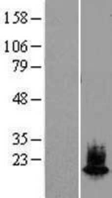 Western Blot: alpha-Synuclein Overexpression Lysate [NBL1-16274]