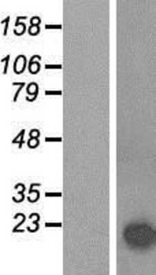 Western Blot: alpha-Synuclein Overexpression Lysate [NBP2-11293]