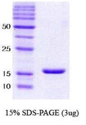 SDS-PAGE: Recombinant Human alpha-Synuclein Protein [NBC1-18331]