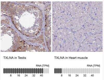 Immunohistochemistry-Paraffin: alpha-Taxilin Antibody [NBP1-91662]