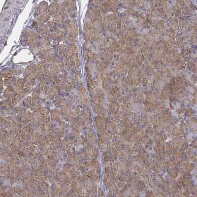 Immunohistochemistry-Paraffin: alpha-Taxilin Antibody [NBP2-56295]