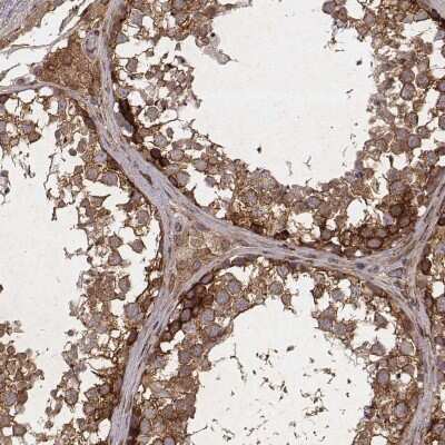 Immunohistochemistry-Paraffin: alpha-Taxilin Antibody [NBP2-56295]