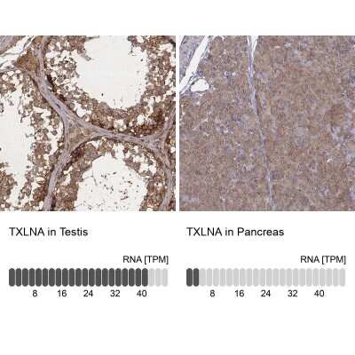 Immunohistochemistry-Paraffin: alpha-Taxilin Antibody [NBP2-56295]