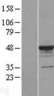 Western Blot: alpha Tubulin 3c Overexpression Lysate [NBL1-17430]