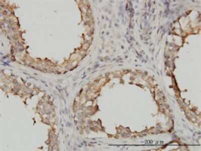 Immunohistochemistry-Paraffin: alpha Tubulin 4a Antibody (2E11) [H00007277-M01]