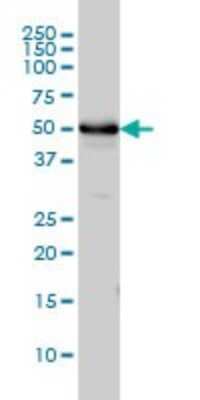 Western Blot: alpha Tubulin 4a Antibody (2E11) [H00007277-M01]