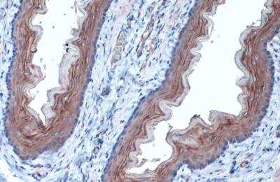 Immunohistochemistry-Paraffin: alpha Tubulin 4a Antibody [NBP2-21604]