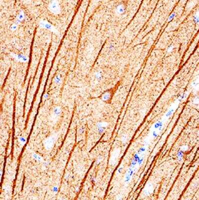 Immunohistochemistry-Paraffin: alpha Tubulin Antibody (961258) [MAB93441]