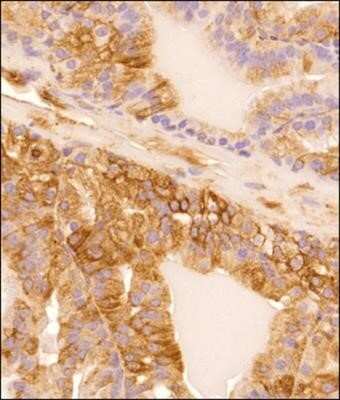 Immunohistochemistry-Paraffin: alpha Tubulin Antibody (DM1A) - Azide and BSA Free [NBP2-80570]