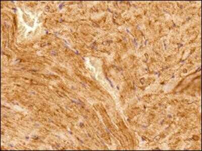 Immunohistochemistry-Paraffin: alpha Tubulin Antibody (DM1A) - Azide and BSA Free [NBP2-80570]