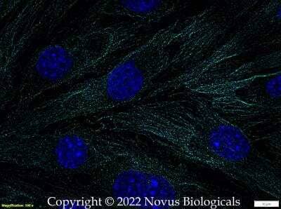 Immunocytochemistry/ Immunofluorescence: alpha Tubulin Antibody (DM1A) - BSA Free [NB100-690]